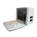Human Ultraschall Scanner MT300V Serie